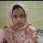 Moroccan police tortures 12-year-old Saharawi girl